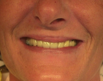 ein strahlendes Lächeln einer glücklichen Patientin.